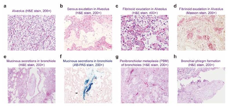 20200327_122920_836.jpg 2.2.jpg