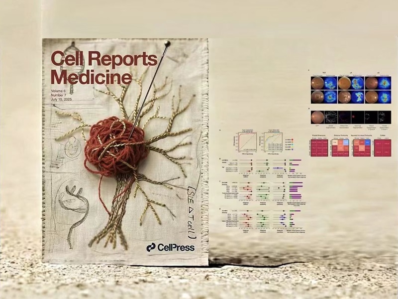 上海交大盛斌团队发表DeepSLE深度学习系统，成果登Cell Reports Medicine封面