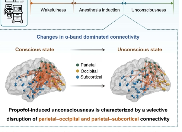 上海交通大学心理学院袁逖飞教授与合作者解码丙泊酚麻醉下的人脑意识连接组
